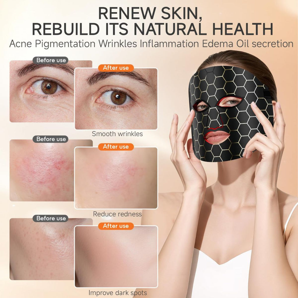 4-Color LED Light Therapy Mask — Face, Rechargeable